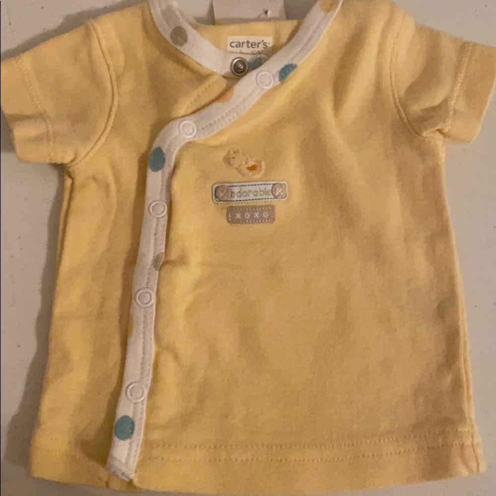 NB yellow button up shirt
